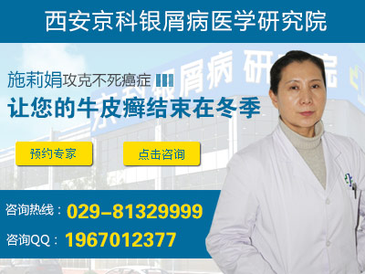 郑州看牛皮癣医院哪个权威